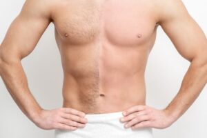 Advantages of removing chest hair