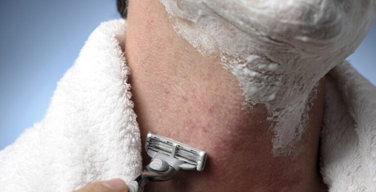 How To Get Rid Of Razor Bumps - A Complete Guide