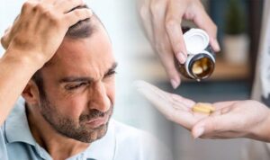 Supplements Can Prevent Hair Loss