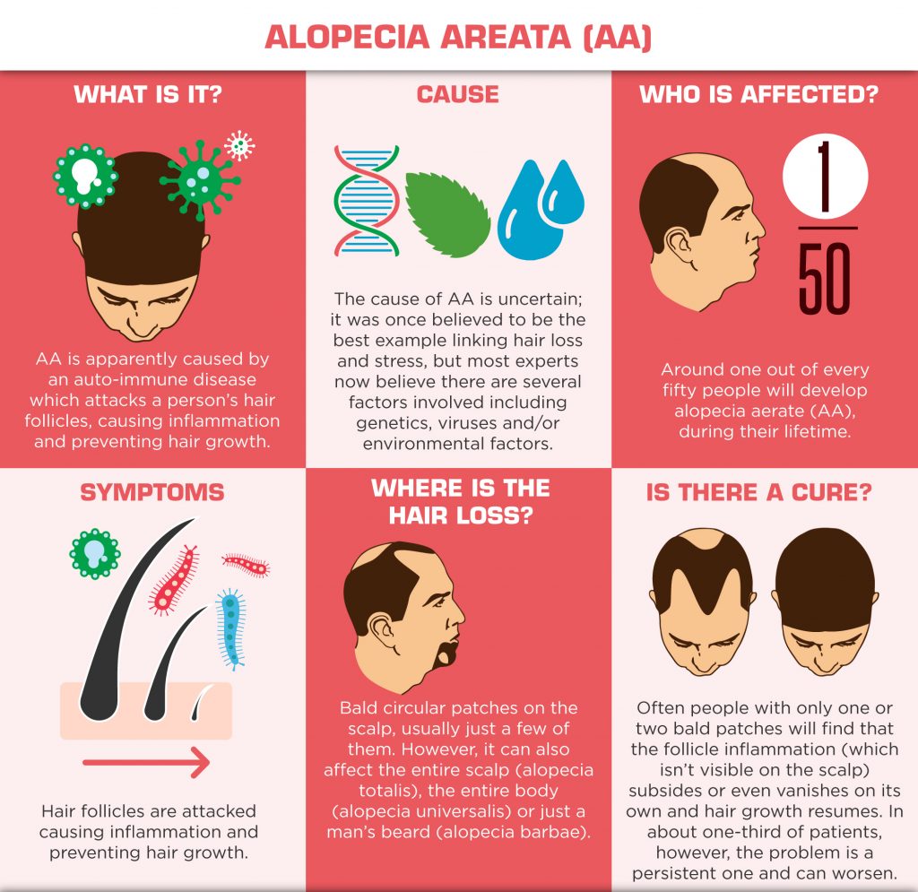 Understanding Hair Loss in Men - Alopecia Areata - AA