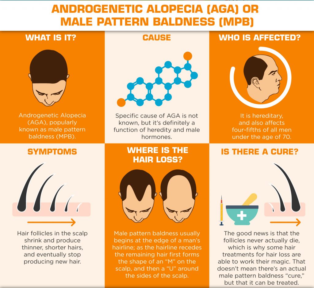 Understanding Hair Loss in Men - Androgenetic Alopecia -AGA