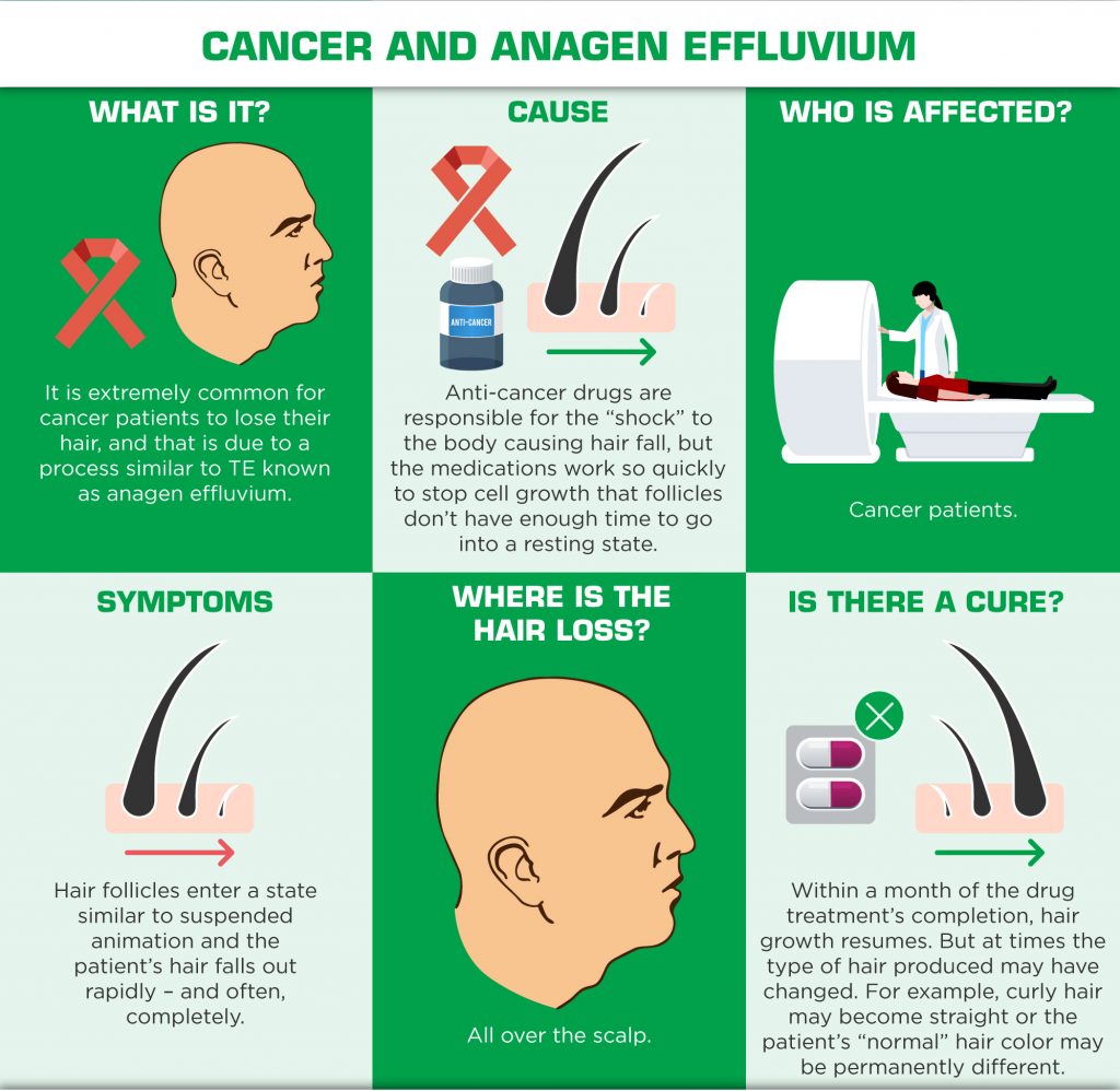 Understanding Hair Loss in Men - Cancer and Anagen Effluvium