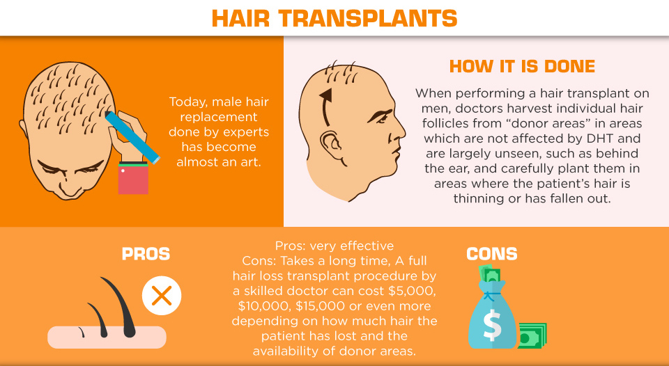 Understanding Hair Loss in Men - hair transplants