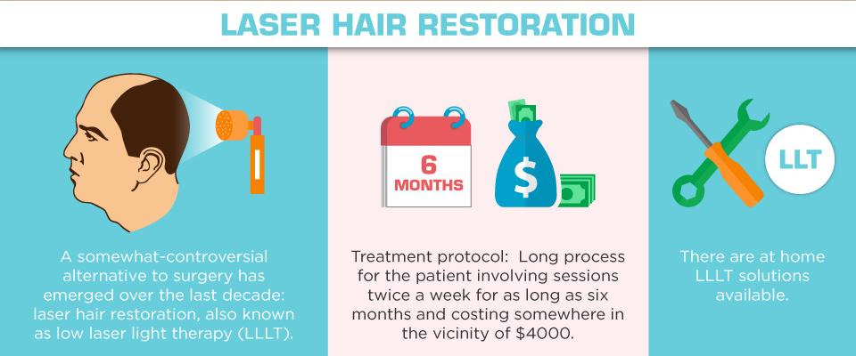 Understanding Hair Loss in Men - laser hair restoration