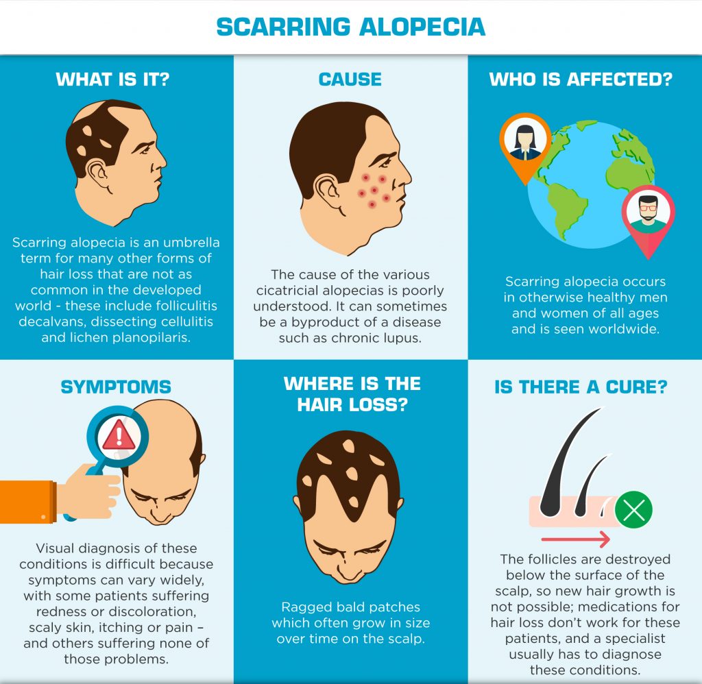 Understanding Hair Loss in Men - Scarring Alopecia