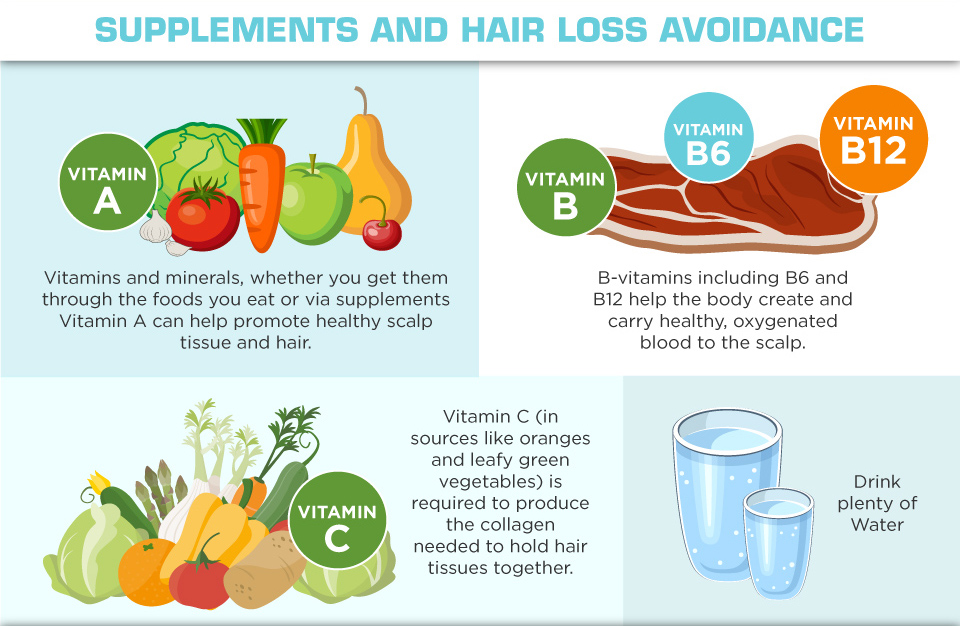 Understanding Hair Loss in Men - supplements and hair loss avoidance