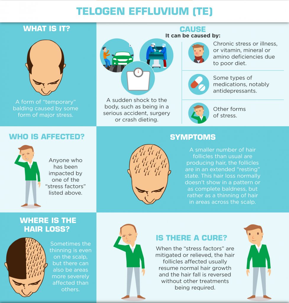 Understanding Hair Loss in Men - Telogen Effluvium - TE